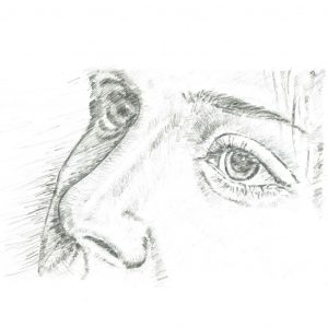 Sarah – Nasal reconstruction